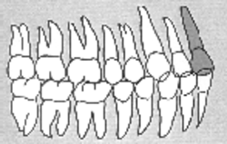 Körper-Zahn-Beziehungen Zahn 11