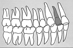 Zahn-Körper-Beziehungen Zahn 12