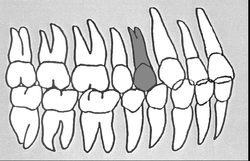Körper-Zahn-Beziehungen Zahn 14