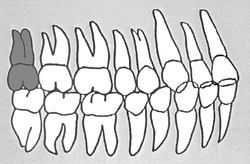 Zahn-Körper-Beziehungen Zahn 18