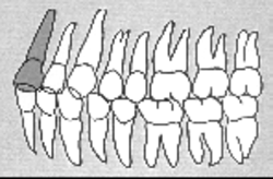 Zahn-Körper-Beziehungen Zahn 21