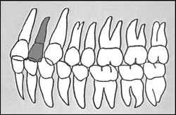 Zahn-Körper-Beziehungen Zahn 22
