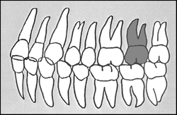 Zahn-Körper-Beziehungen Zahn 27