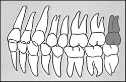 Zahn-Körper-Beziehungen Zahn 28