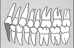 Zahn-Körper-Beziehungen Zahn 31