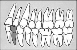 Zahn-Körper-Beziehungen Zahn 32