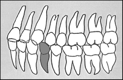 Zahn-Körper-Beziehungen Zahn 34
