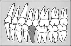 Zahn-Körper-Beziehungen Zahn 35