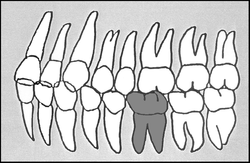 Zahn-Körper-Beziehungen Zahn 36