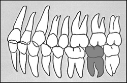 Zahn-Körper-Beziehungen Zahn 37