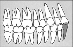 Zahn-Körper-Beziehungen Zahn 41