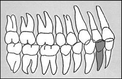 Zahn-Körper-Beziehung Zahn 42