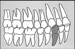 Zahn-Körper-Beziehungen Zahn 43