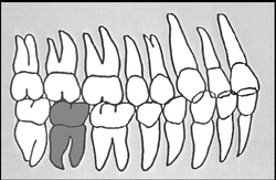 Zahn-Körper-Beziehungen Zahn 47