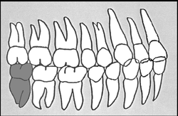 Zahn-Körper-Beziehungen Zahn 48